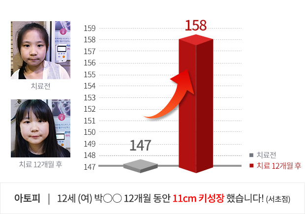 10세 (여) 5개월 동안 4.8cm  키성장 했습니다!