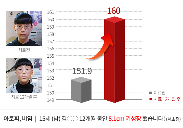 14세 (남) 3개월 동안 2.3cm  키성장 했습니다!