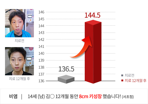 14세 (남) 3개월 동안 2.3cm  키성장 했습니다!