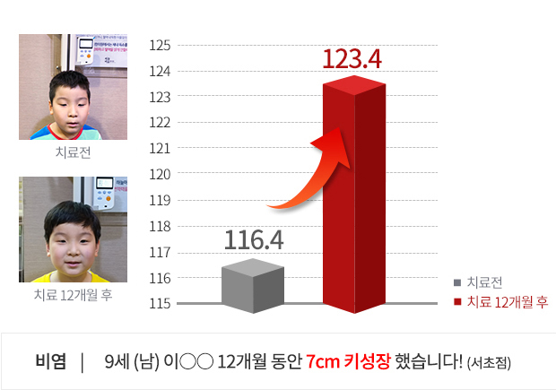 14세 (남) 3개월 동안 2.3cm  키성장 했습니다!