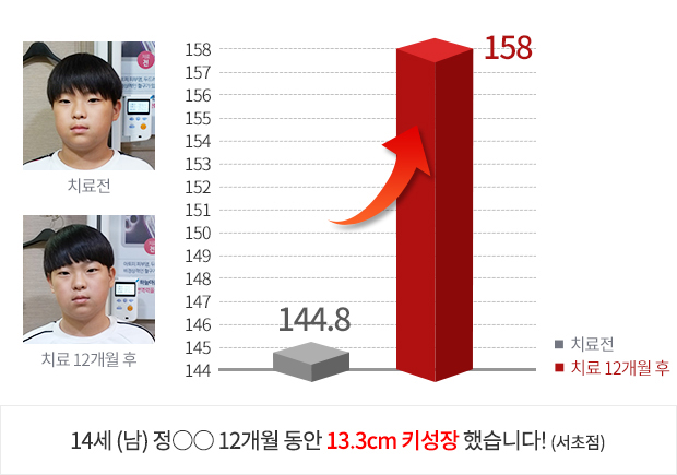 8세 (남) 6개월 동안 4.7cm  키성장 했습니다!