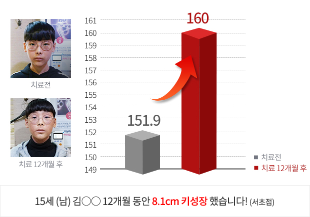 12세 (남) 3개월 동안 2.5cm  키성장 했습니다!