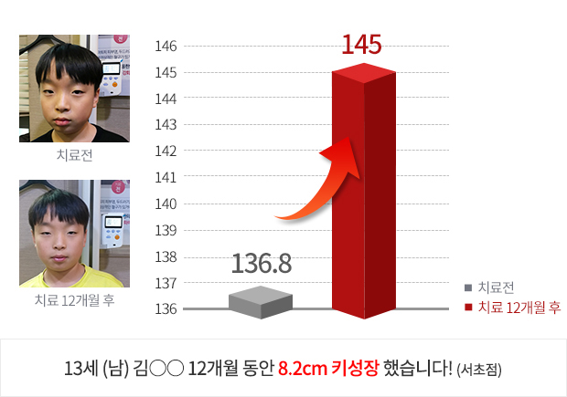 10세 (여) 4개월 동안 3.9cm  키성장 했습니다!