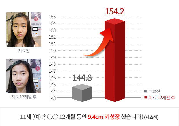 11세 (여) 3개월 동안 1.2cm  키성장 했습니다!